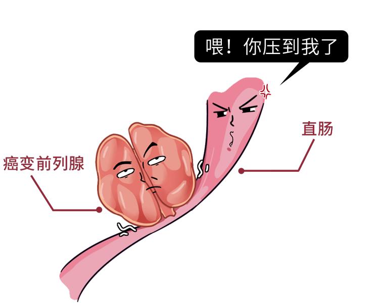 前列腺喝咖啡_前列腺喝咖啡_咖啡对前列腺什么作用